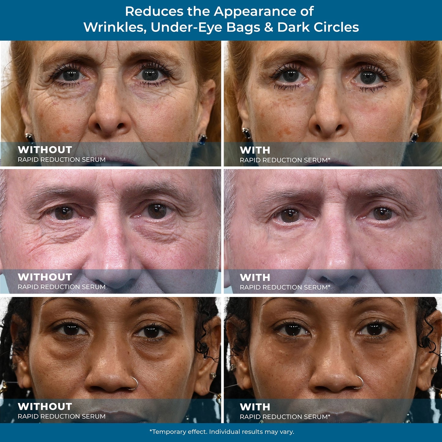 Plexaderm Rapid Reduction Eye Serum Full Size Tube