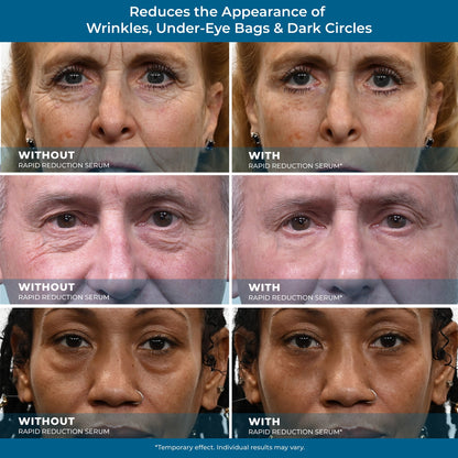 Plexaderm Rapid Reduction Eye Serum Full Size Tube