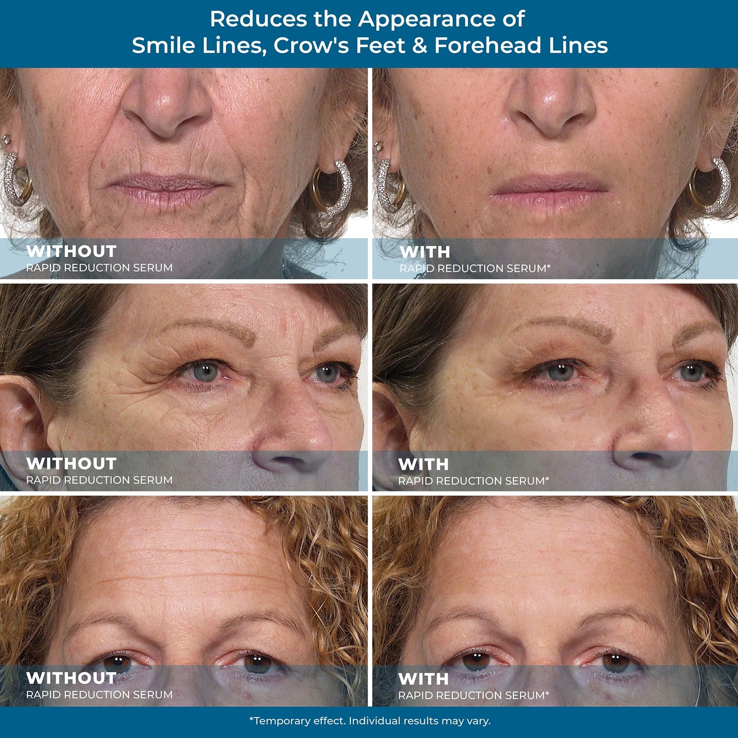 Plexaderm Rapid Reduction Eye Serum Full Size Tube